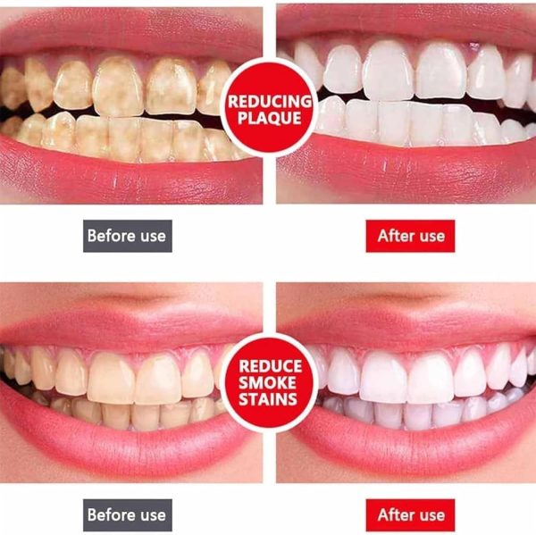 Yayashi Sp-4 Ultra Whitening Toothpaste Probiotic Stain Remover / Stain Removing Toothpaste, Protects Gums Freshens Breath, For Everyone