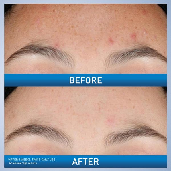 Cerave Resurfacing Retinol Serum