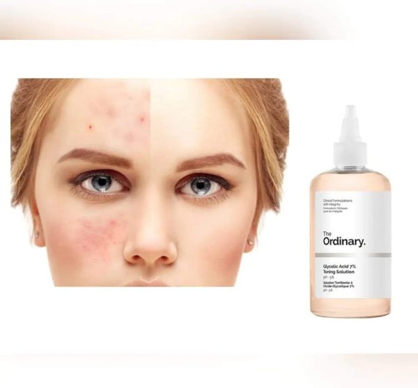 The Ordinary Glycolic Acid 7% Toning Solution Lightweight Liquid Provides Sun Protection – 240ml