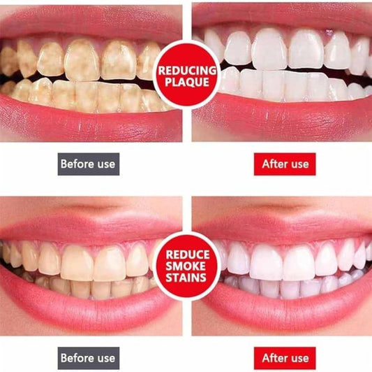 Yayashi Sp-4 Ultra Whitening Toothpaste Probiotic Stain Remover / Stain Removing Toothpaste, Protects Gums Freshens Breath, For Everyone